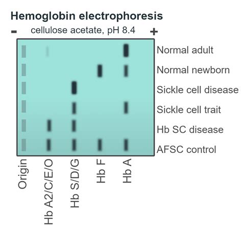 interpreting electrophoresis results|Hemoglobin Electrophoresis .